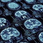 Medical Imaging, Machine Learning to Align in 10 Key Areas