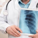 Study: Google AI outperforms radiologists in diagnosing lung cancer